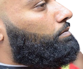 Broad or Lined Shave